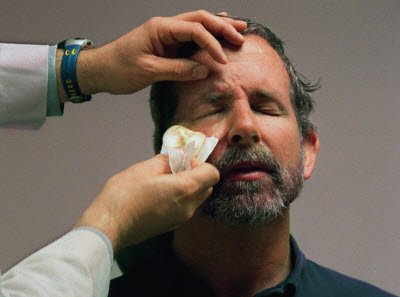 Mike's bandages coming off for the first time
